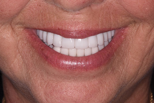 Dentist in Pleasantville NJ