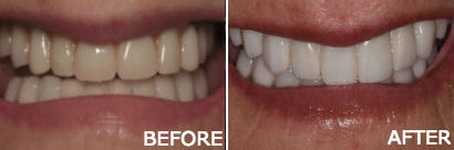 Dentist Atlantic City