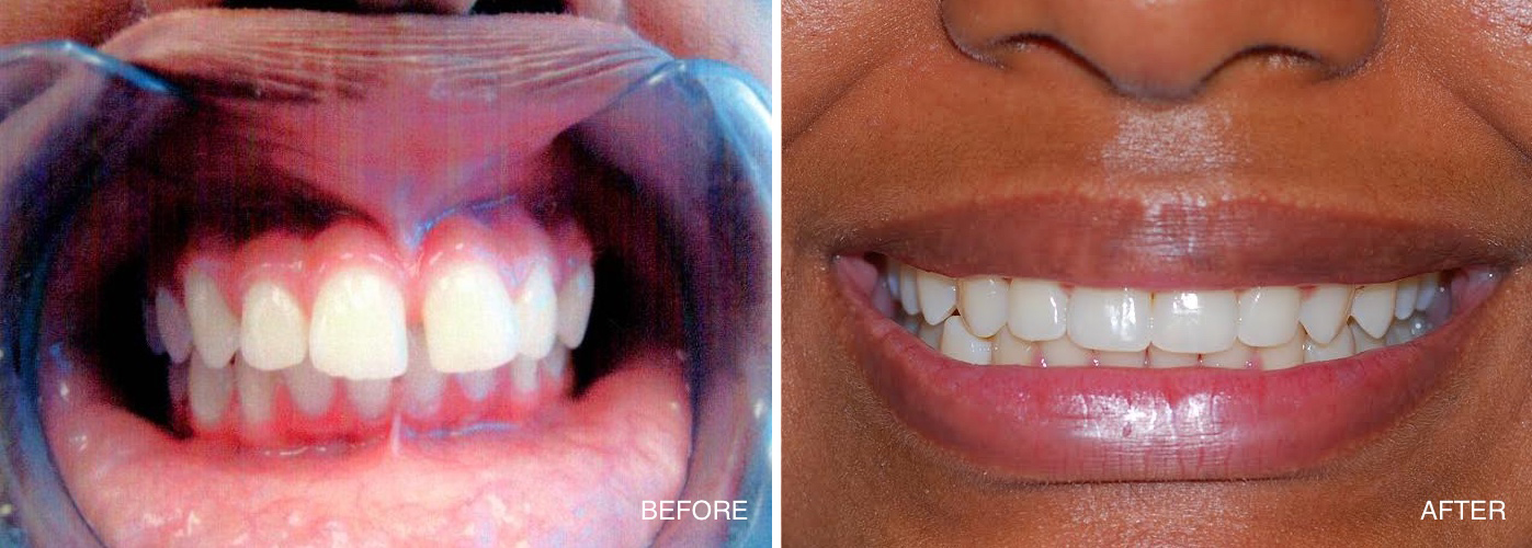 Dentist in Pleasantville NJ