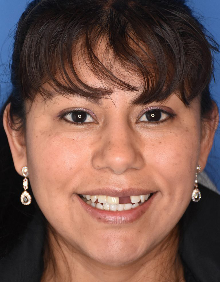 Dentist in Pleasantville NJ