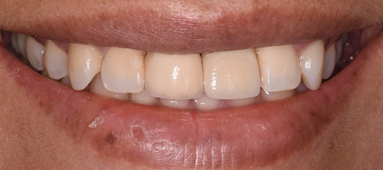 Emergency Dentist Atlantic City