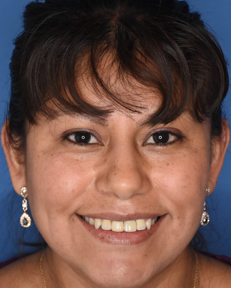 Dentist in Pleasantville NJ