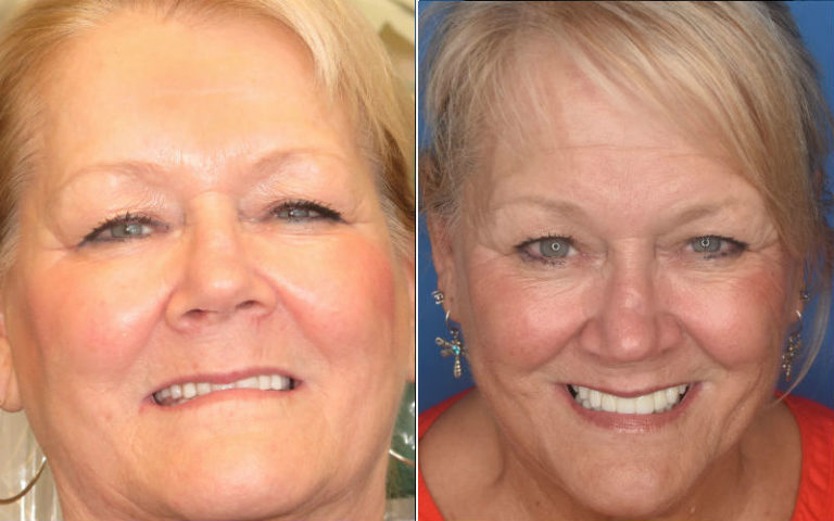 Dental Office in Pleasantville NJ;