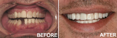 Pleasantville NJ Cosmetic Dentist