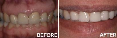 Emergency Dentist Pleasantville NJ;