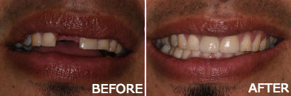 Family Dentist in Pleasantville NJ