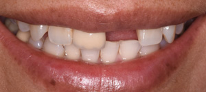 Dental Office in Pleasantville NJ