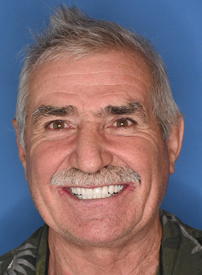 Emergency Dentist Atlantic City