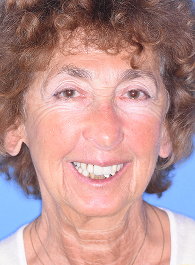 Pleasantville NJ Cosmetic Dentist