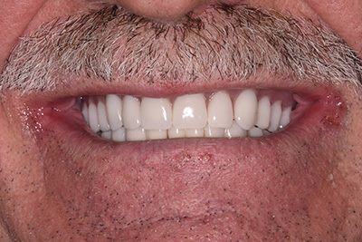 Pediatric Dentist Atlantic City