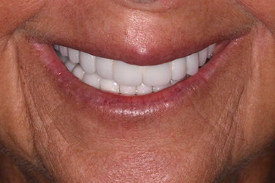 Dentist in Atlantic City