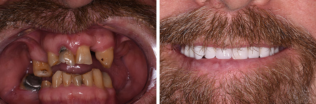 Emergency Dentist Atlantic City