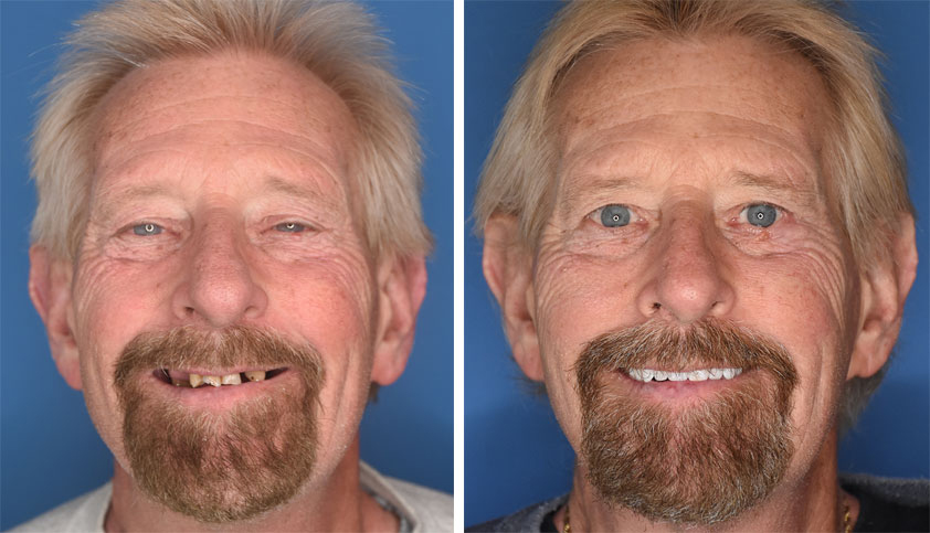 Pediatric Dentist Atlantic City