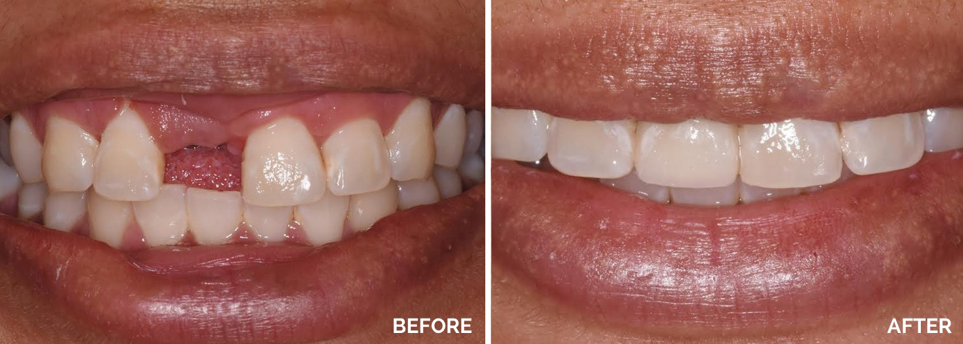 Pleasantville NJ Cosmetic Dentist