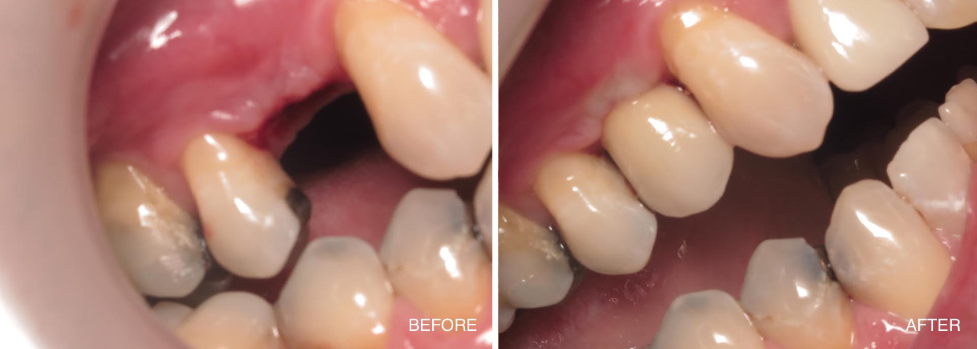 Family Dentist in Pleasantville NJ