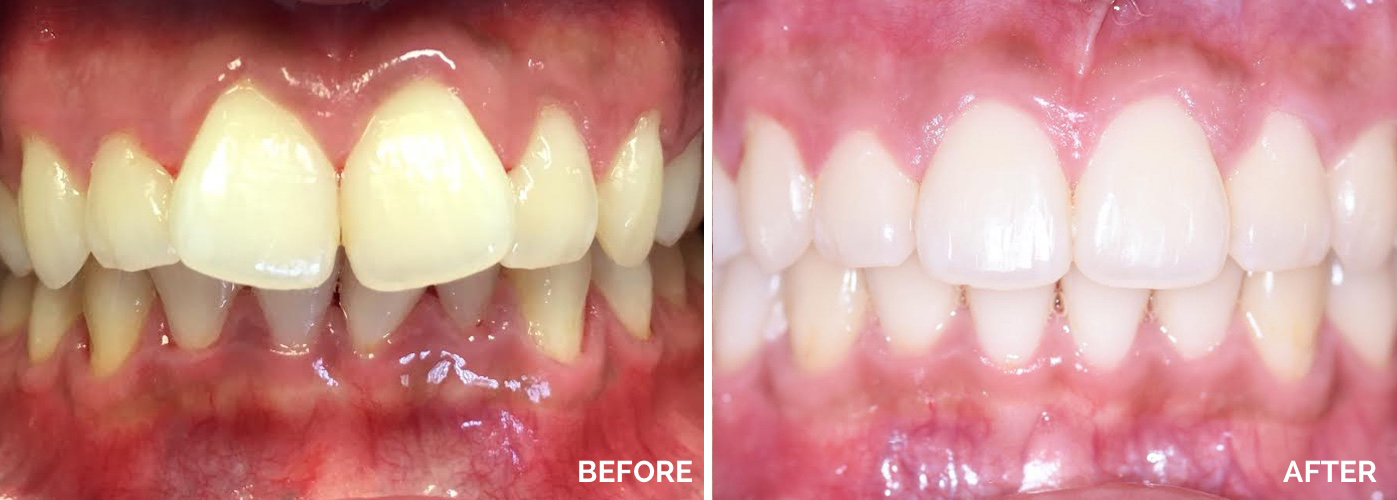 Family Dentist in Pleasantville NJ