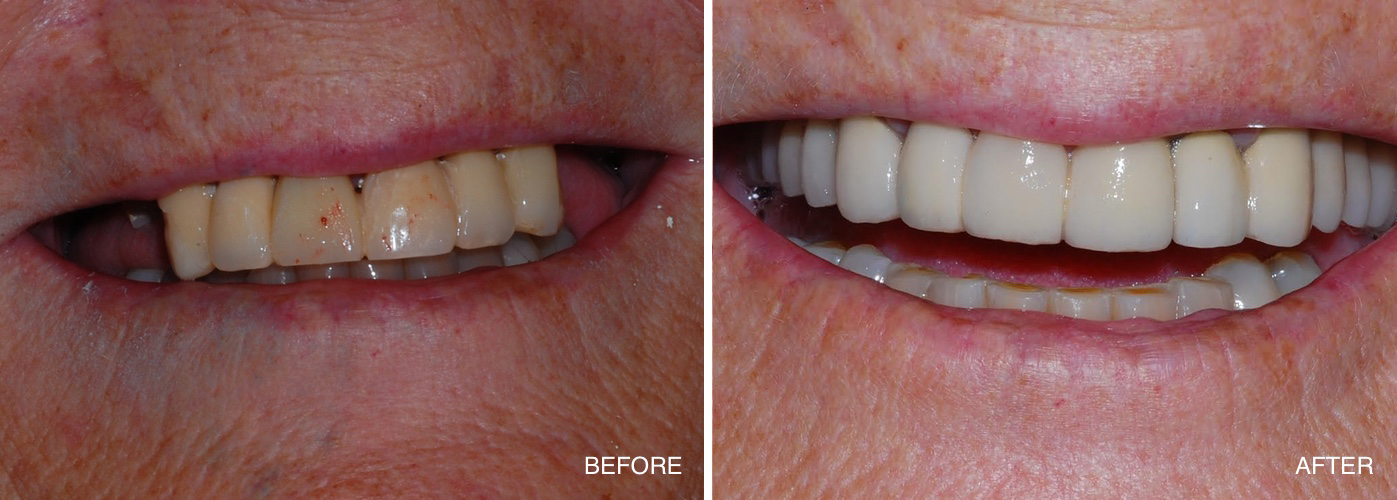 Dental Contouring Before and After Pictures in Atlanta, GA - Smile Envy  Dental & Orthodontics