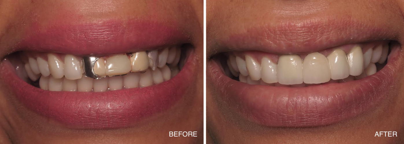 Family Dentist in Pleasantville NJ