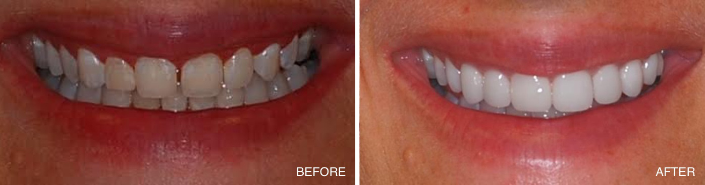 Emergency Dentist Atlantic City