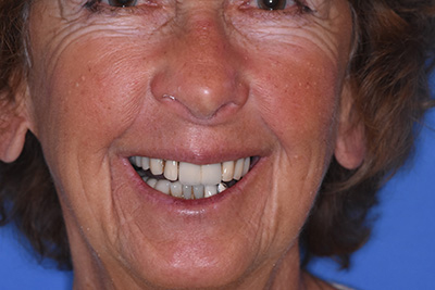 Pediatric Dentist Atlantic City