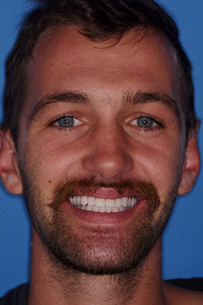 Pleasantville NJ Cosmetic Dentist