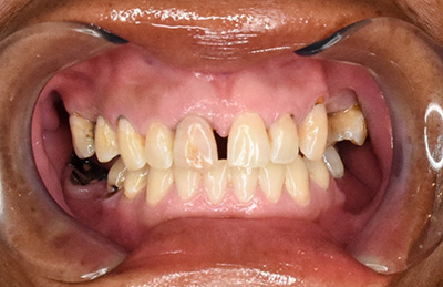 Emergency Dentist Pleasantville NJ