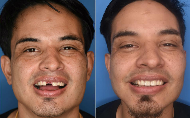  Family Dentist in Atlantic City