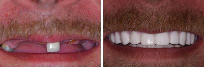 Family Dentist in Pleasantville NJ