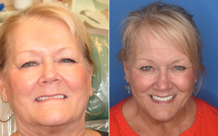 Pediatric Dentist Atlantic City