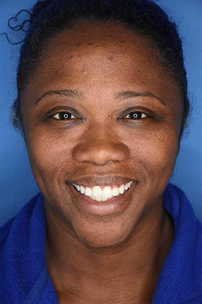 Dentist in Pleasantville NJ