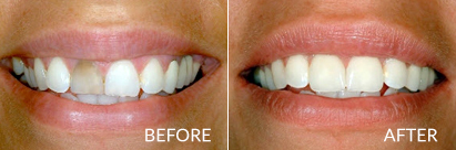 Emergency Dentist Pleasantville NJ