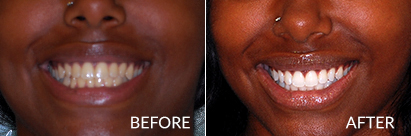 Pleasantville NJ Cosmetic Dentist