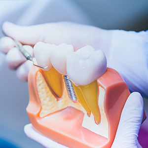 Family Dentist in Pleasantville NJ