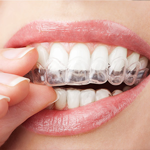 Pleasantville NJ Cosmetic Dentist